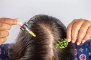 rosemary for hair growth ans scalp health